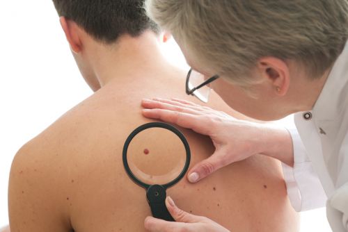 Dermatologist Diagnosing Skin Cancer Using Magnifying Glass on Mole