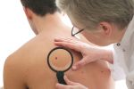 Dermatologist Diagnosing Skin Cancer Using Magnifying Glass on Mole